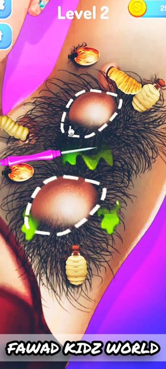 ASMR Removal Dog Ticks & Maggot Infected Armpit | Severely Injured Animation