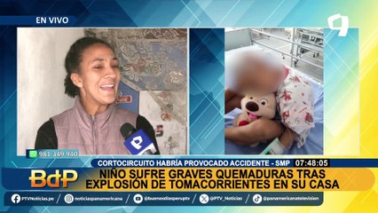 Niño sufre graves quemaduras tras explosión de tomacorrientes en su casa: Madre culpa a Enel