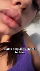 Dudak dolgusu yaptıran genç kıza babasının verdiği tepki gündem oldu