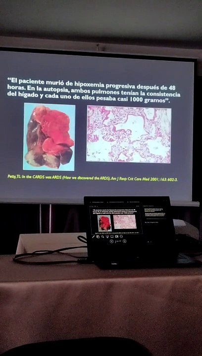 historia de la vm y ards primera parte