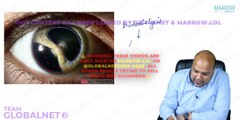 Ocular trauma yw opthalmology