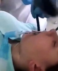 Endoskopiye alınan hastanın midesinden 1,5 metrelik canlı çıktı