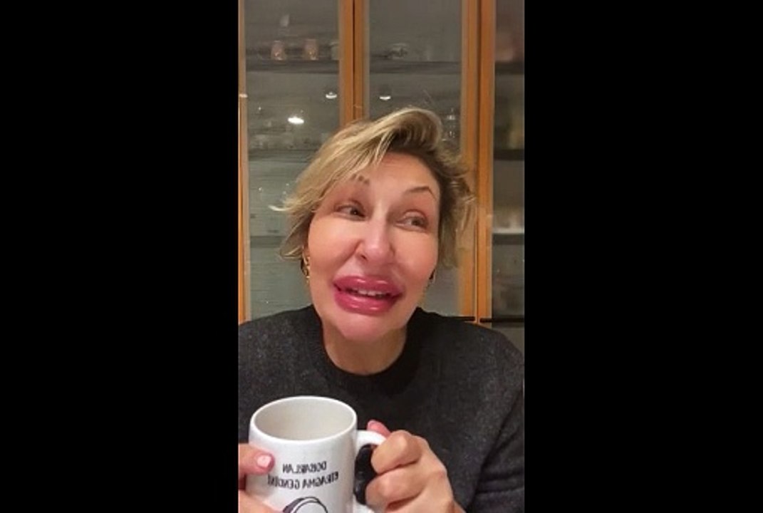 Gülse Birsel’in botoksları alay konusu oldu. Botoks yapanları ti’ye almıştı 