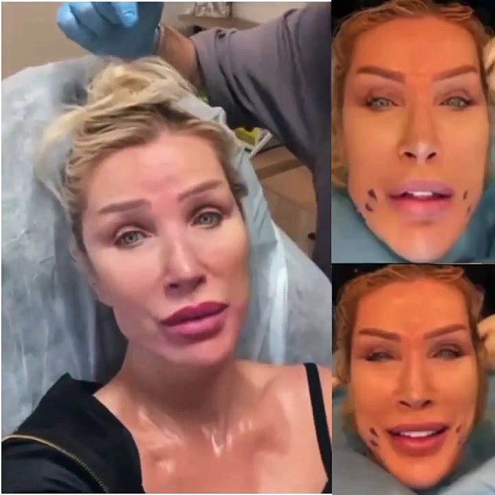 Seda Sayan çenesine kontür attırdı. Görenler 59 yaşında olduğuna inanamıyor