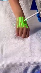 R - Evolution in Vascular Illumination Technology #shorts #shortvideo #video #virals #videoviral #innovationhub