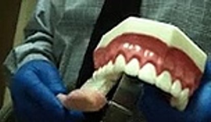 The Bounce Style of Toothbrushing by Dr. Ralph Winge