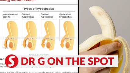 EP226: Can hypospadias affect one’s reproductive life? | PUTTING DR G ON THE SPOT