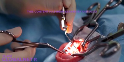 Clinical anatomy of inner ear ENT