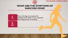 What are the symptoms of varicose veins?