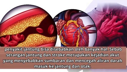 6 Jenis Penyakit Jantung yang Perlu Dikenali dan Sering menyerang banyak orang