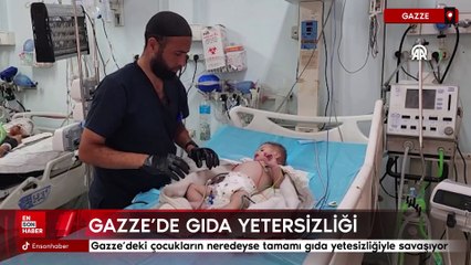 Gazze'deki çocukların neredeyse tamamı gıda yetesizliğiyle savaşıyor