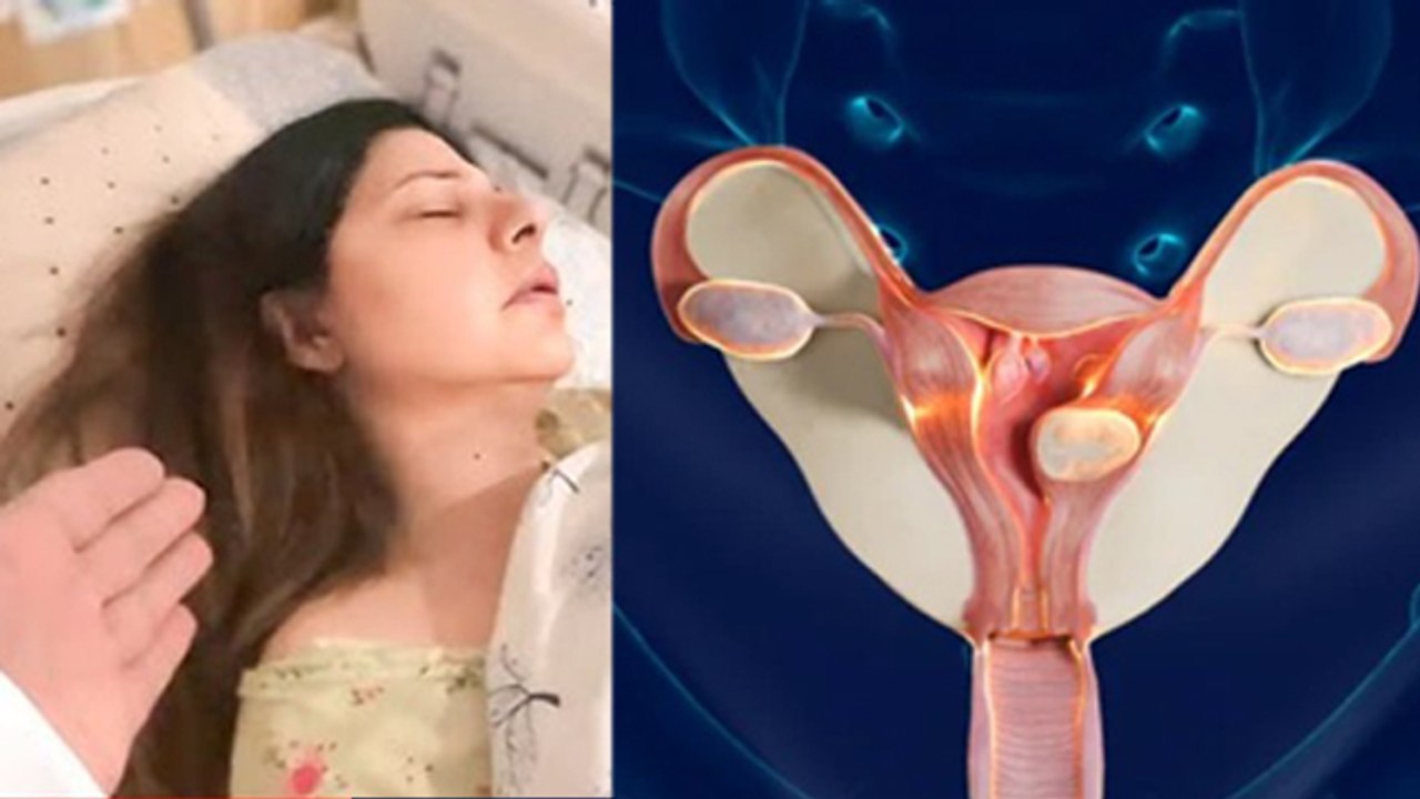 Sambhavna Seth Uterine Polyps Removal Recovery Time, After Surgery Symptoms In Hindi | Boldsky