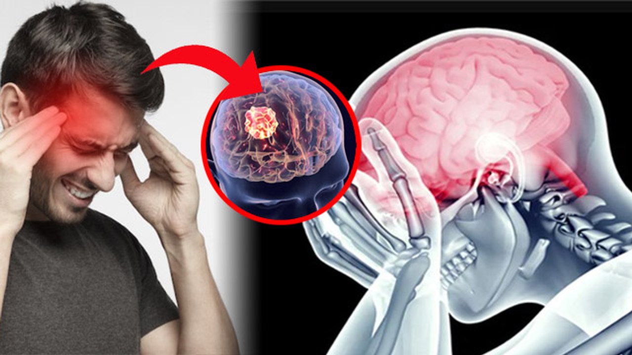 Morning Headache Brain Tumor Symptom, Regular Migraine Treatment In Hindi|Boldsky