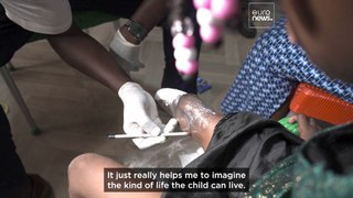 Watch: The guardian angel providing prosthetic limbs to amputated children in Nigeria