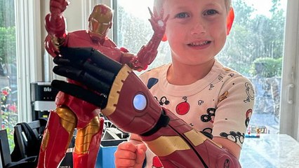 'My five-year-old son is the youngest person to have a bionic arm!'