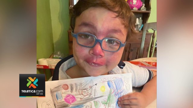 tn7-Niño con malformación de cerebro, piel y ojos requiere ayuda para ser operado en EE. UU.-110624