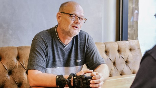 Amputee gets 3D-printed bionic gauntlet after he lost his fingers in accident