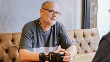 Der Mann, der bei einem Arbeitsunfall die Finger verloren hat, ist der erste in Deutschland, der 3D-gedruckte Finger erhält