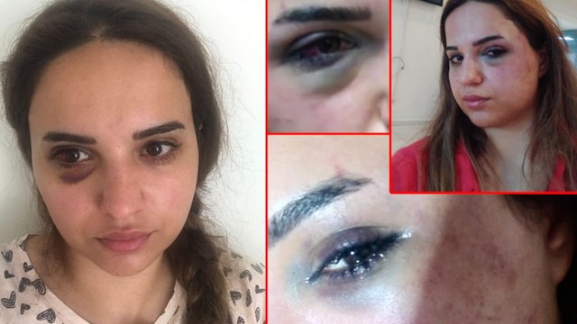 Bir yıldır boşanmak istediği eşi darbedip, bıçakladı