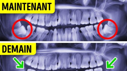 Le saviez-vous sur le corps humain le plus surprenant que vous entendrez jamais