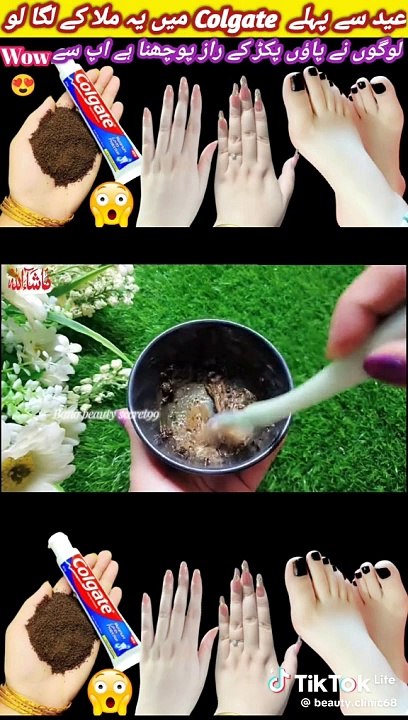 Fine video noska