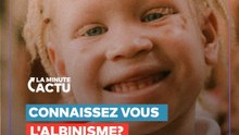 13 juin, Journée internationale de sensibilisation à l'albinisme