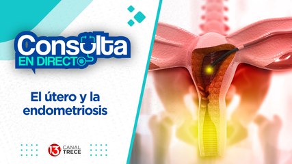 13 junio 2024 Consulta en Directo | El útero y la endometriosis.