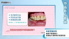 齒黃不整羞開口 星鑽貼片讓師勇於嶄露笑容｜禾睿牙醫診所 - 作品節錄｜遠大整合行銷