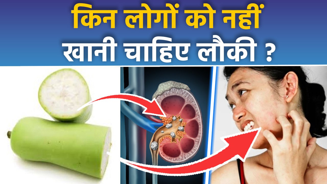 Bottle Gourd Side Effects In Hindi: किन लोगों को लौकी नहीं खाना चाहिए, Low BP से लेकर Kidney Stone..