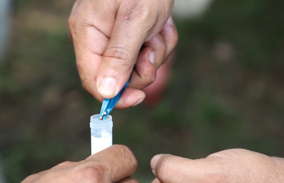 Minsa de Herrera confirma dos casos positivos de gusano barrenador en humanos