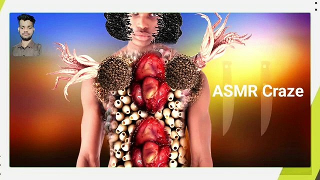 Asmr men body maggots removal video | asmr | asmr animation