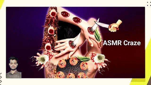 Asmr Dog Ticks Removal Asmr Animation | asmr | asmr video