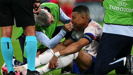 Kylian Mbappé sufre una fractura en la nariz