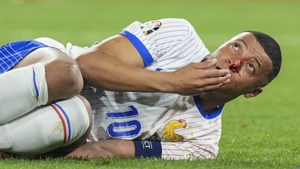 'He's in bad shape' - Deschamps on Mbappe injury in France win