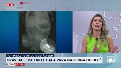 Grávida leva tiro e bala fica alojada na perna do bebê