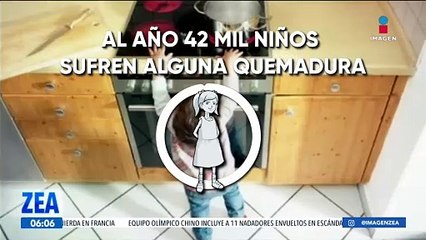 En México se estima que 128 mil personas al año sufren algún tipo de quemadura