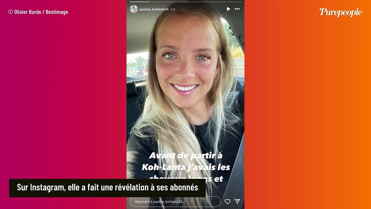 On ne le savait pas, mais Pauline (Koh-Lanta 2024) n'est pas sortie indemne de l'aventure : des photos impressionnantes dévoilées