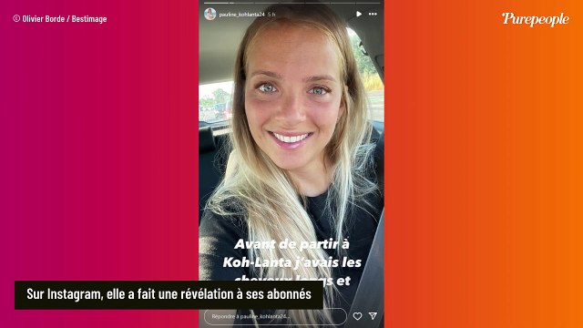 On ne le savait pas, mais Pauline (Koh-Lanta 2024) n'est pas sortie indemne de l'aventure : des photos impressionnantes dévoilées