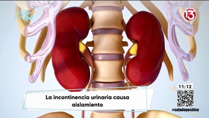 Pase en vivo - Incontinencia urinaria
