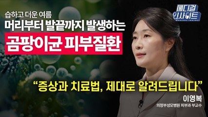 [메디컬 인사이트 37회] 피부과 전문의가 전하는 '곰팡이균 피부질환의 증상과 치료법' / YTN