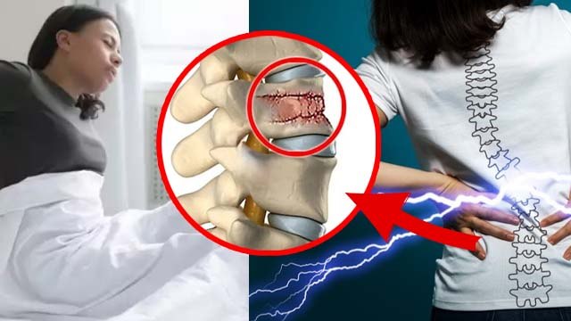 Night Back Pain Relief: रात में पीठ दर्द क्यों होता है, Instant Home Remedy In Hindi | Boldsky