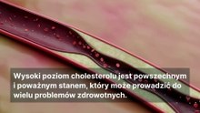 3 oznaki wysokiego poziomu cholesterolu na ciele