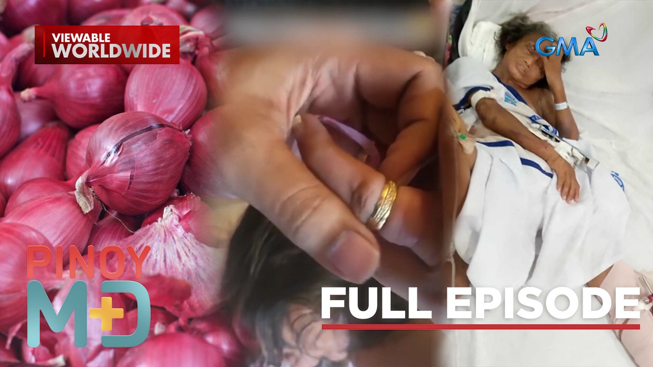 Babae, nasagasaan ng motor; Singsing na ‘di matanggal, ano ang solusyon? (Full Episode) | Pinoy MD
