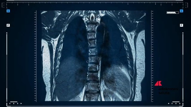 Congresso Sirm: grazie alle radiomica diagnosi oncologiche precoci
