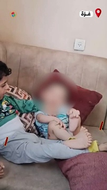 المجاعة في شمال #غزة تنهش أجساد الأطفال