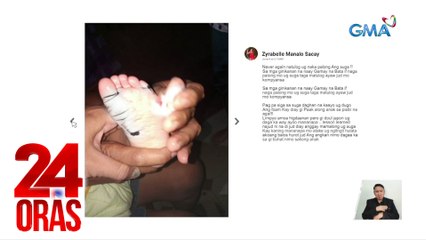 First-aid sa kagat ng daga: Pigilan ang pagdurugo, linisin ang sugat, isugod sa ospital; pabakunahan | 24 Oras