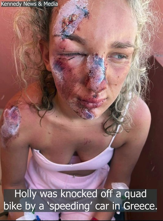 Zakynthos: Brit left 'permanently scarred' afte...
