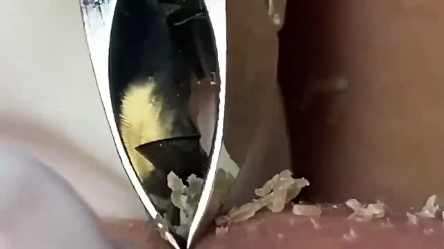 relax,Satisfying,nose blackheads,tweezers,acne treatment