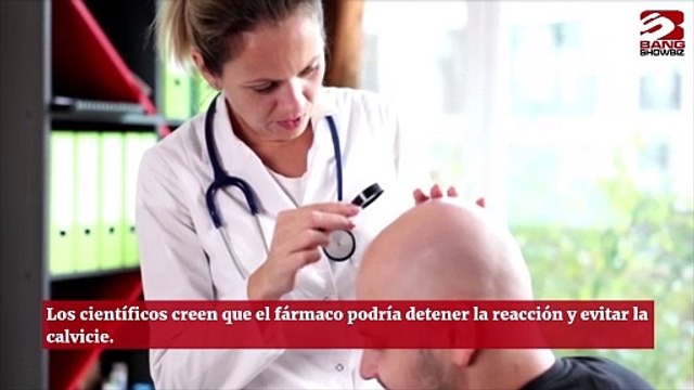 Científicos descubren la cura de la calvicie