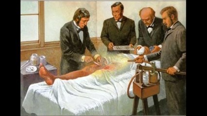 Joseph Lister: Revolutionizing Modern Surgery | நவீன அறுவை சிகிச்சையின் தந்தை ஜோசப் லிஸ்டரின் கதை